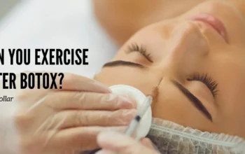 can you exercise after botox